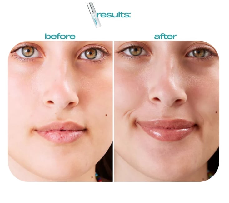 💋 Achieve Lush, Plump Lips - 49% OFF - ✨BP Spicule Plumping Lip Shot