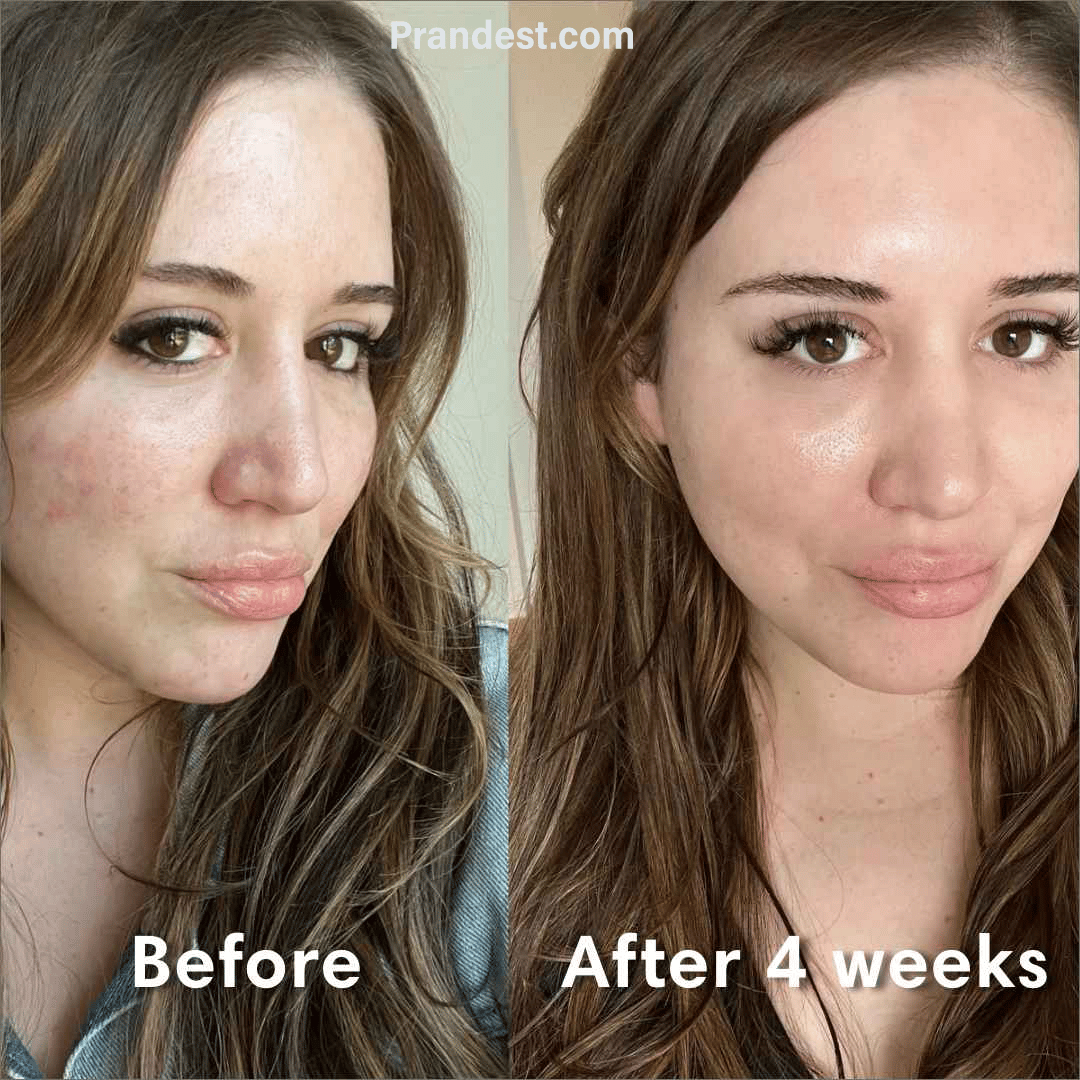 🔥Bio-Collagen Face mask