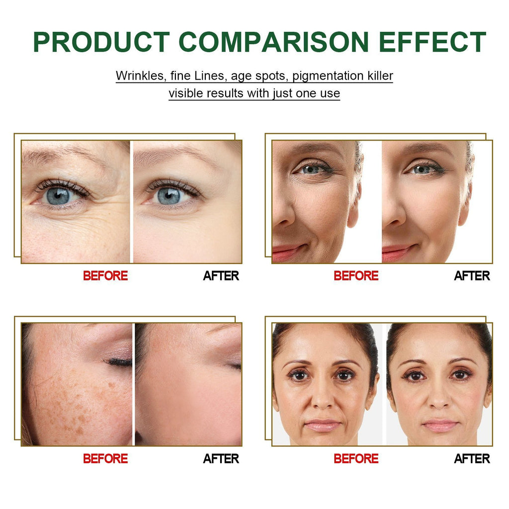 🎁30 Day Anti-Aging Treatment Serum - Botox Face Serum