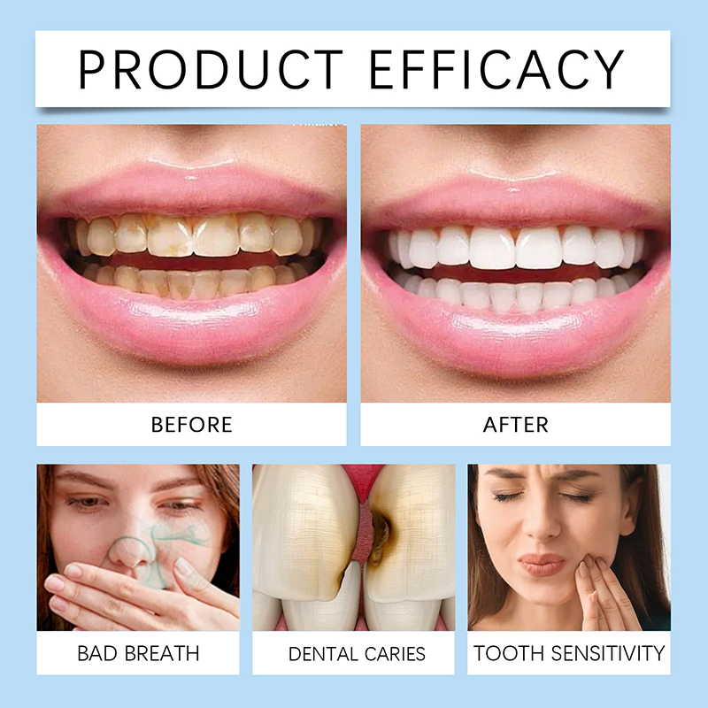 🌟 Daily Dental Care Spray – Your On-the-Go Oral Health Shield!