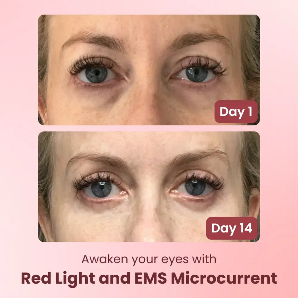 Red Light Eye Massager