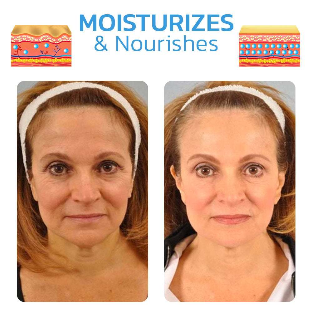 🎁30 Day Anti-Aging Treatment Serum - Botox Face Serum