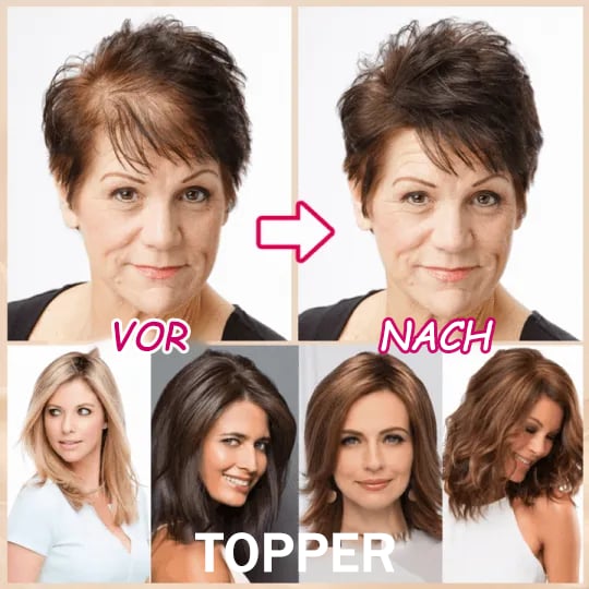 🔥💥Breathable Natural Hair Tips for Women with Thinning Hair