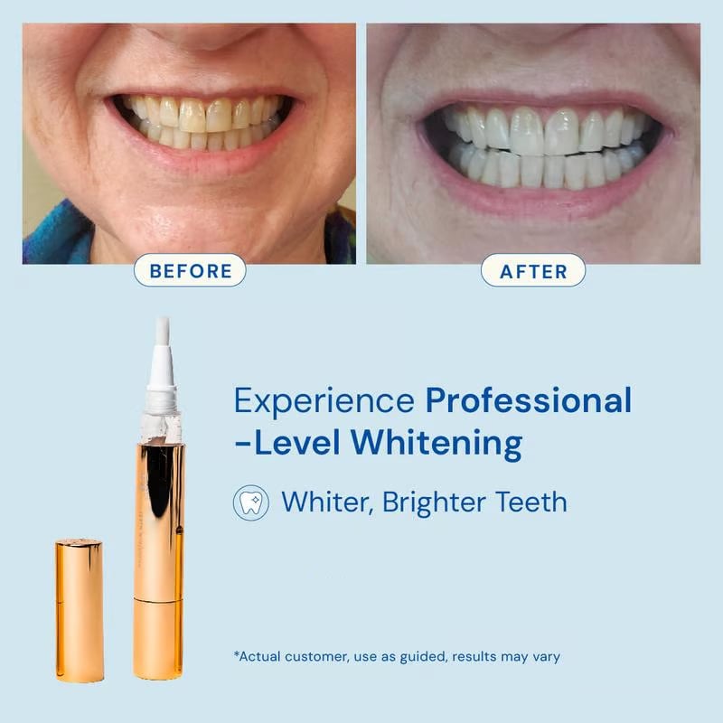 Whitening Pen for Stain Removal & Whiter Teeth