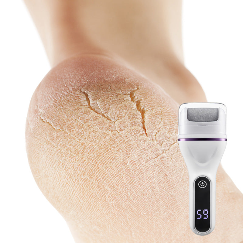 🔥Portable Electric Foot Callus Remover