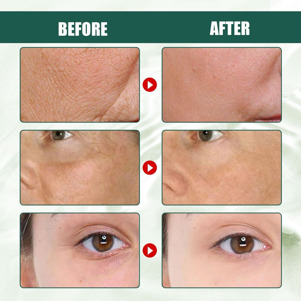 🎁30 Day Anti-Aging Treatment Serum - Botox Face Serum