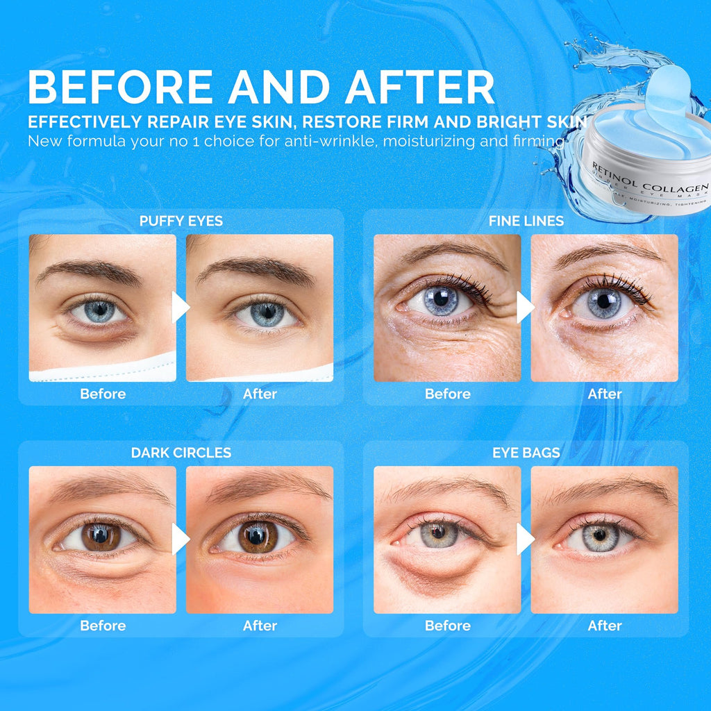 Under Eye Patches for Dark Circles: 60 Pcs Retinol Collagen Eye Gels Mask - Reduce Wrinkles Puffy & Bags