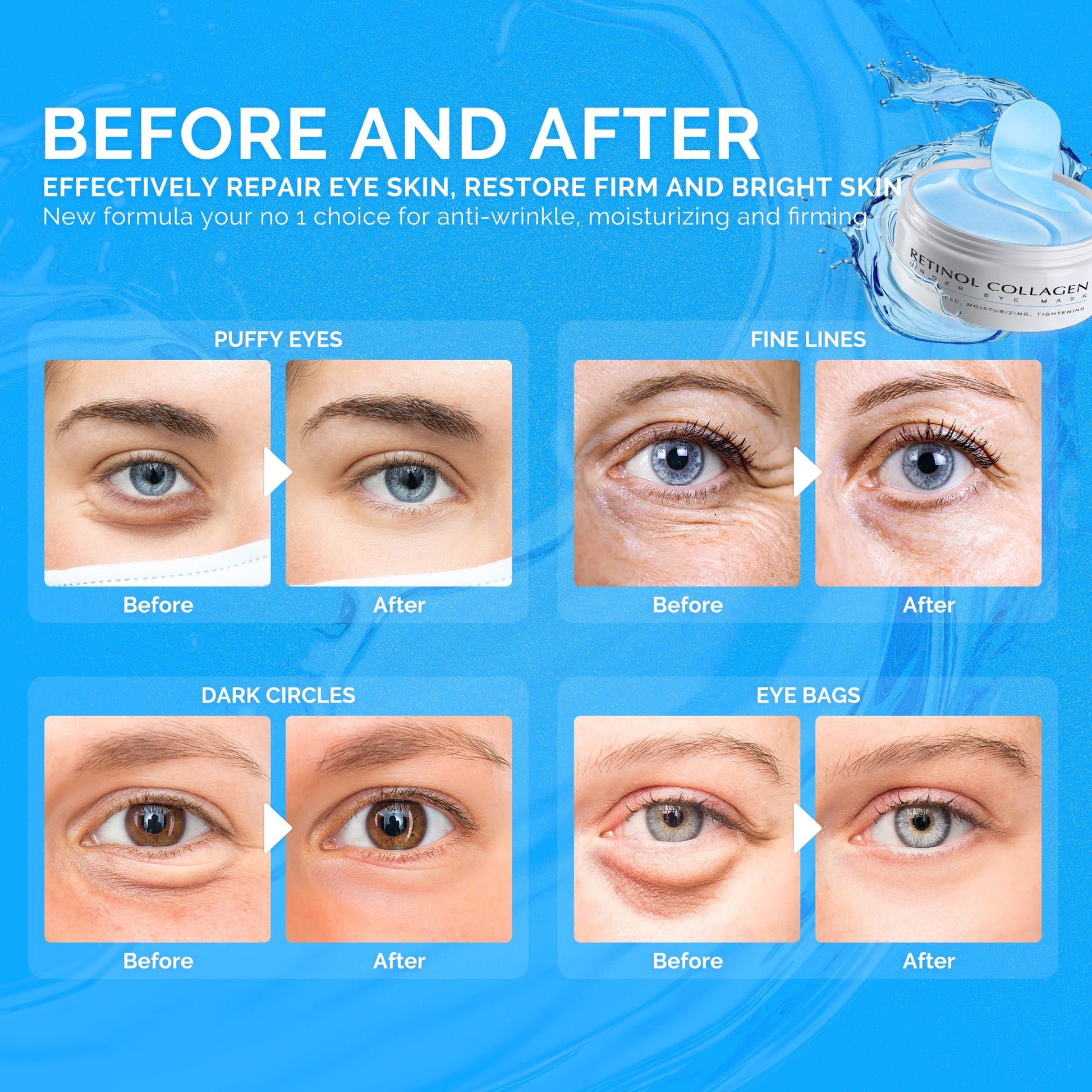 Under Eye Patches for Dark Circles: 60 Pcs Retinol Collagen Eye Gels Mask - Reduce Wrinkles Puffy & Bags