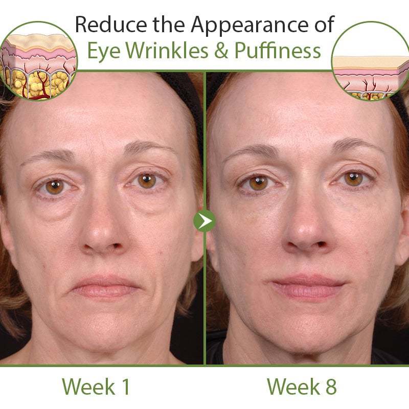 🎁30 Day Anti-Aging Treatment Serum - Botox Face Serum