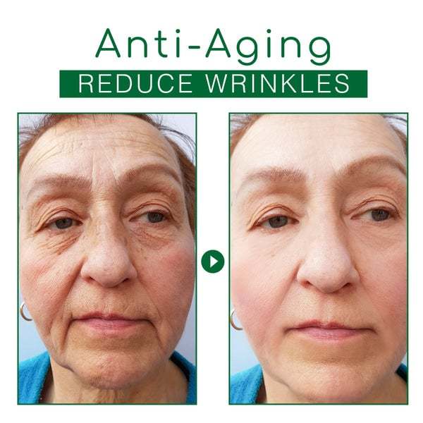 🎁30 Day Anti-Aging Treatment Serum - Botox Face Serum