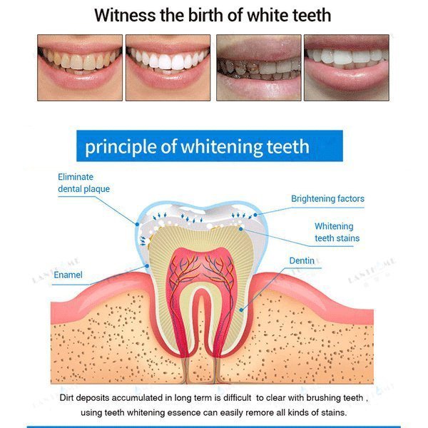 Mintsincerely TM Teeth Whitening Pens