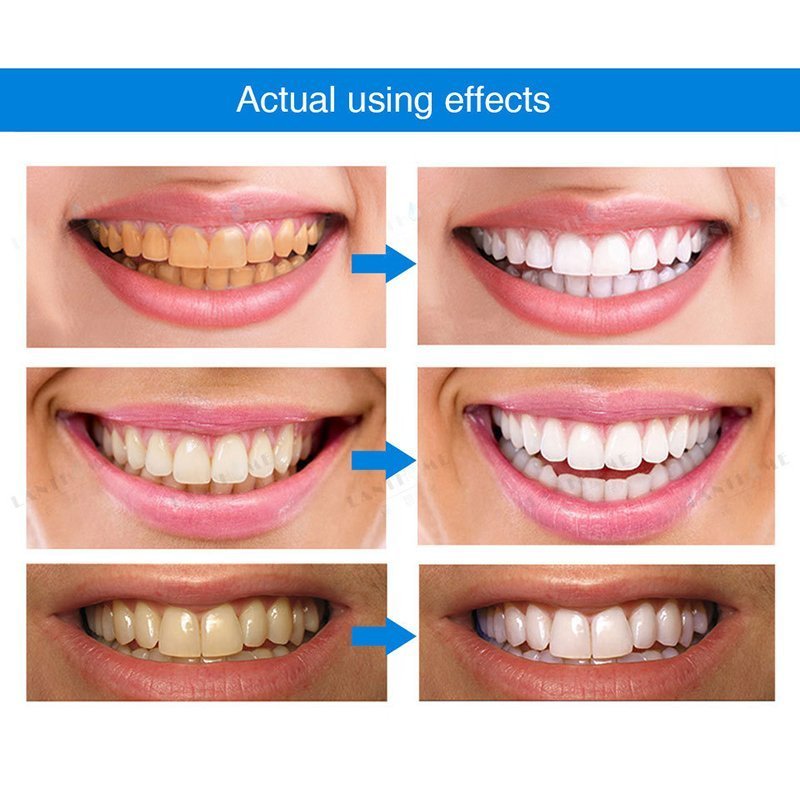Mintsincerely TM Teeth Whitening Pens