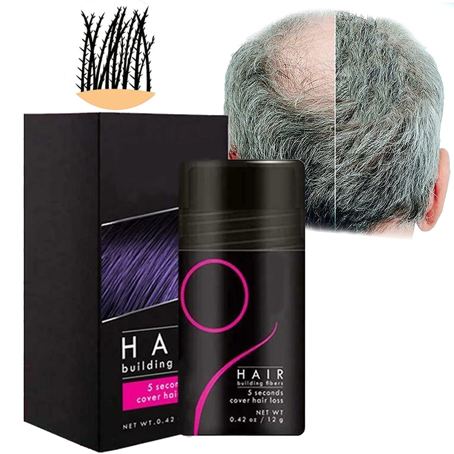 🔥🔥 - Fluffup secret hair fiber powder-Effective hair supplement