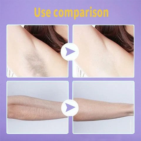 😍Summer Hot sale-Crystal Hair Eraser